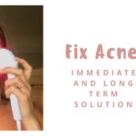 led treatment for acne
